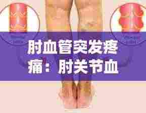 肘血管突发疼痛:肘关节血管鼓起来一按就疼