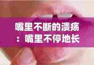 嘴里不断的溃疡：嘴里不停地长溃疡 